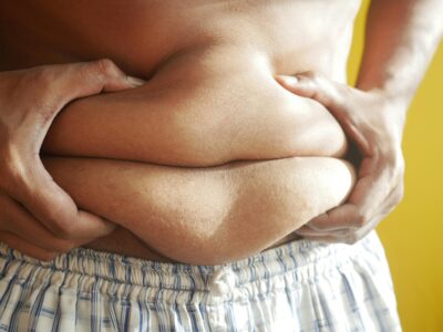 OVERWEIGHT AND OBESITY - EFFECTIVE TREATMENT.